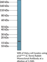 p16INK4A (C-Term) Rabbit Monoclonal Antibody
